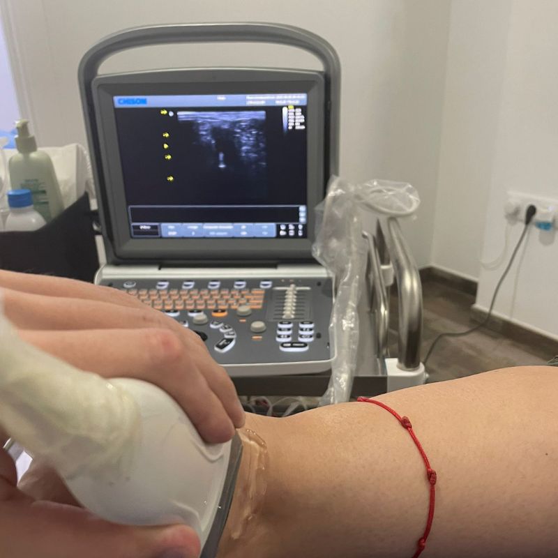Ecógrafo en clínica de fisioterapia avanzada en Montoro