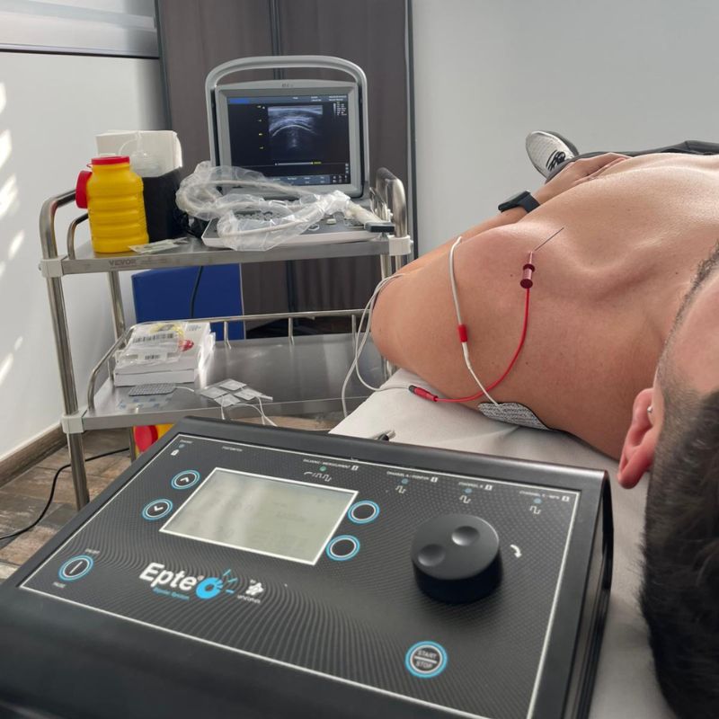 Equipo de electrólisis percutánea terapéutica EPT en clínica de fisioterapia en Montoro